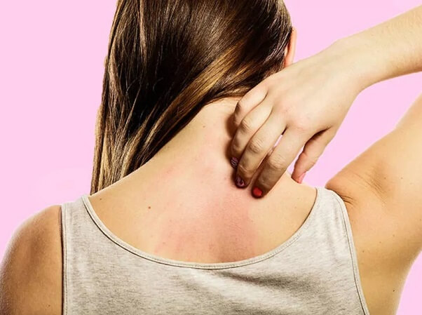 Khi bệnh nhân dị ứng thuốc cần được xử lý kịp thời